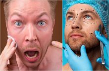 Kauno plastikos chirurgas, gražinęs recidyvisto nosį, tapo operacija nepatenkinto paciento įkaitu